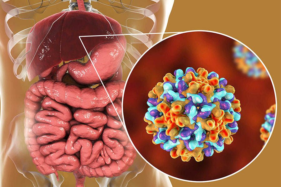 Các loại bệnh về gan thường gặp nhất và cách điều trị cho từng loại
